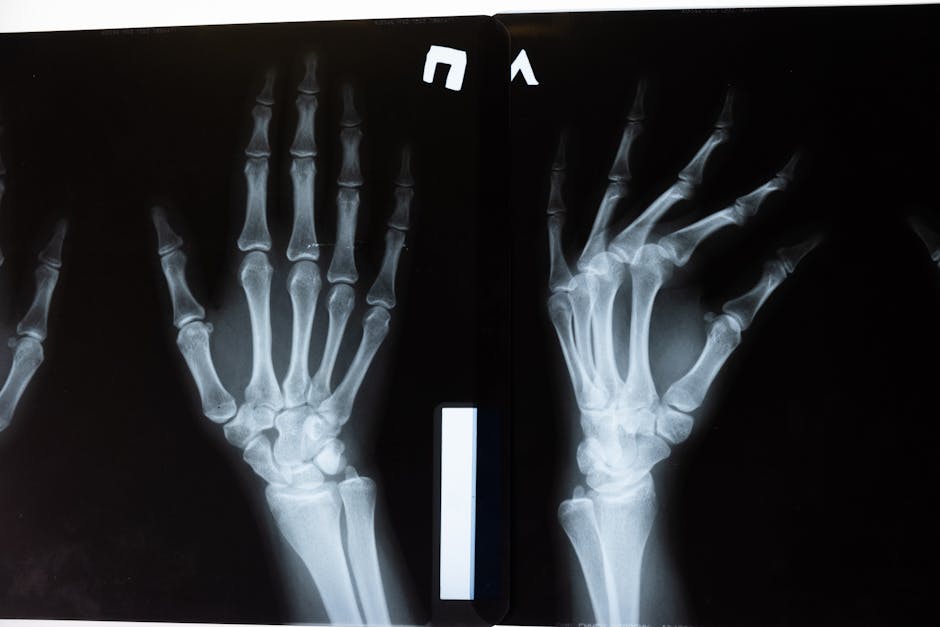 Best Orthopedic Doctor in Ranchi – Dr. MD Arif | Joint & Bone Specialist